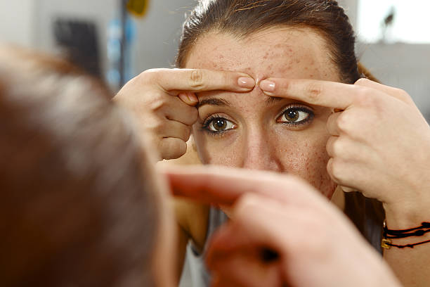 Que faire quand on a une peau acnéique ?